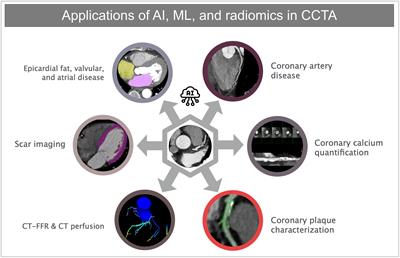 Frontiers Artificial Intelligence In Coronary Computed Tomography